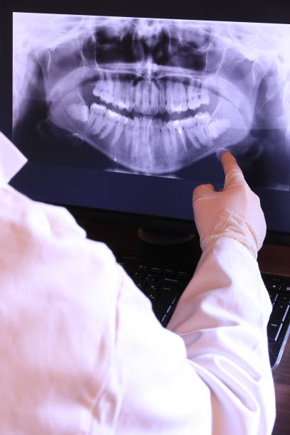 Best Emergency Root Canal Treatment in Polk City, FL